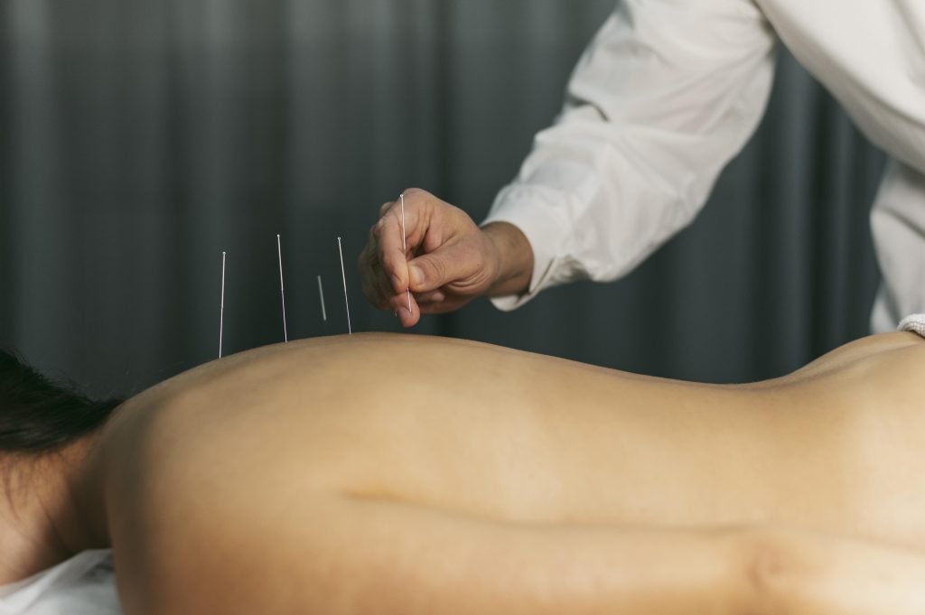 Acupuncturist in Weert